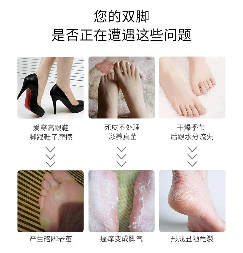 Household Electric Pedicure Tool Dead Skin Removing Calluses USB Rechargeable Digital Display Electric Vacuum Automatic Foot Grinding Pedicure Device