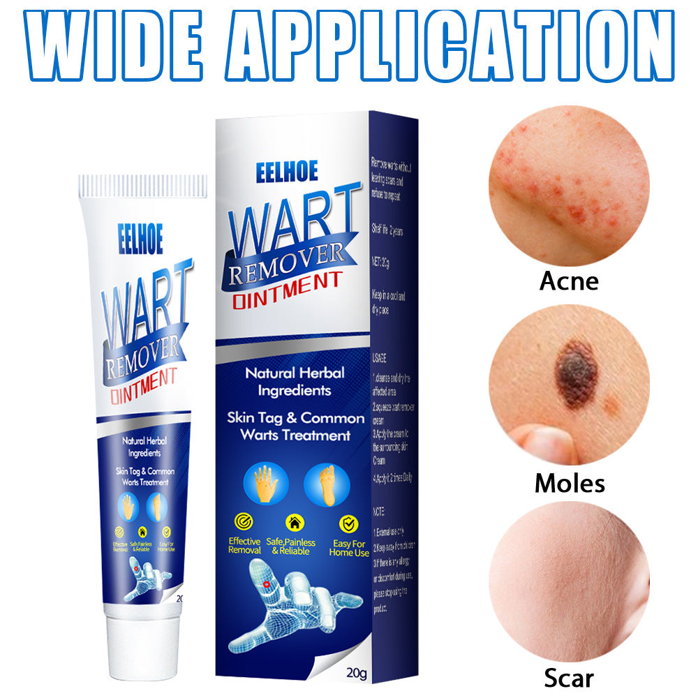 Zhongcao Keyou Liquid Skin Warts Ordinary Yukeyou Ointment Wart Removing Cream