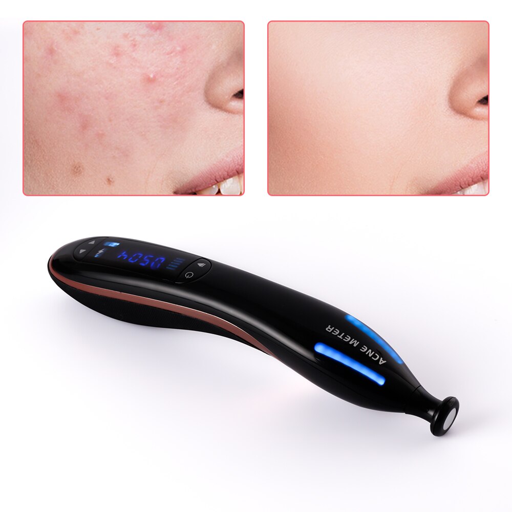 Plasma Pen Scar Acne Spot Removal Anti Wrinkle Aging Therapy Blue Light Acne Treatment Pen Beauty Device Face Skin Care Machine